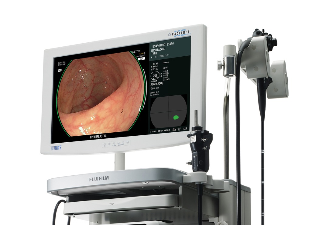 Equipamento de colonoscopia utilizado no processo de colonoscopia preparo e realização do exame no Hospital Mãe de Deus.