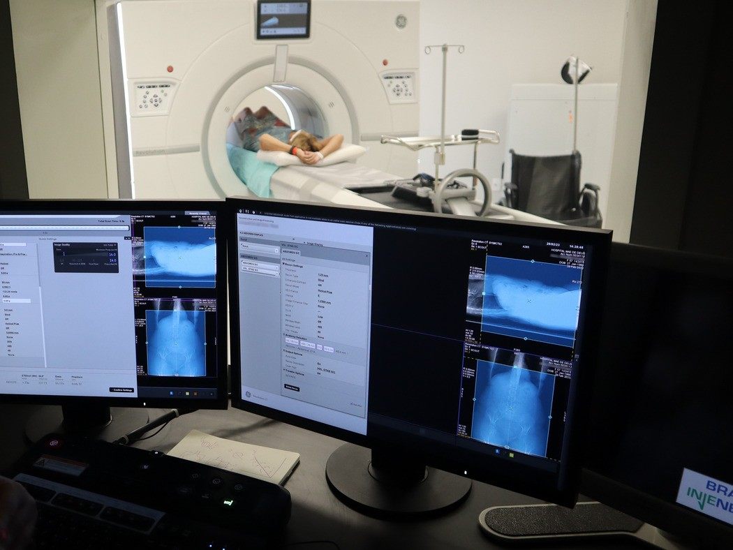 Paciente realizando tomografia computadorizada com monitor de imagens médicas ao fundo em centro de diagnóstico, ilustrando artigo sobre exames de imagem Porto Alegre