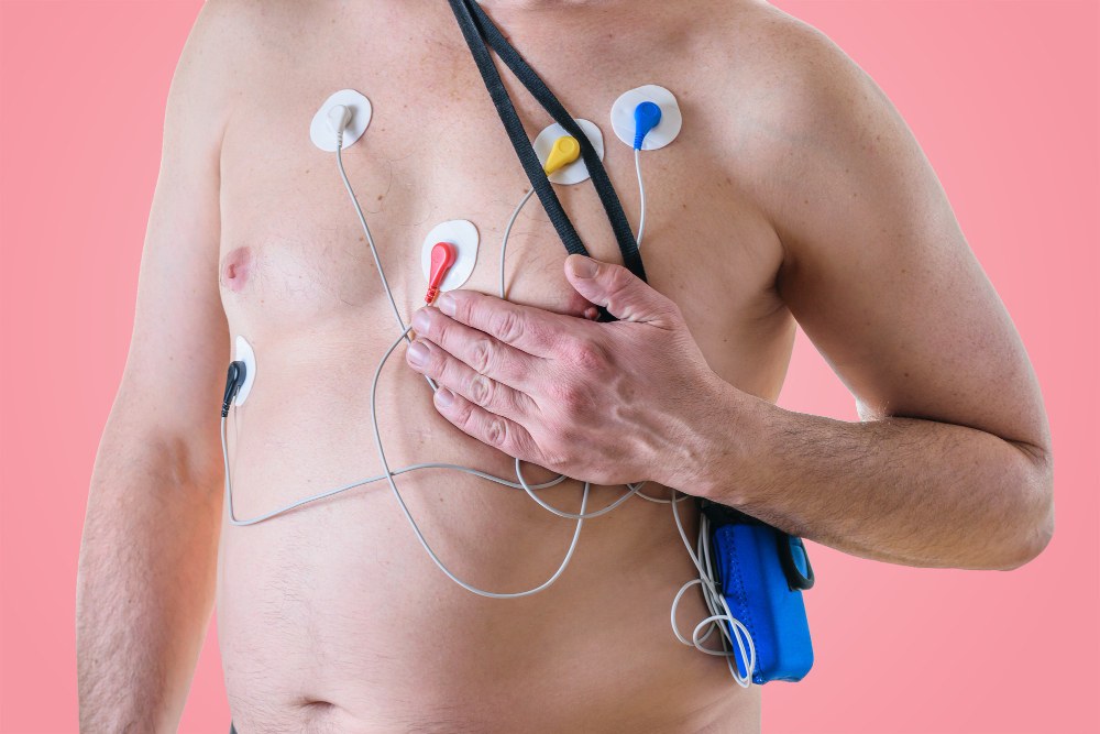Pessoa com eletrodos fixados no tórax e aparelho portátil de monitoramento cardíaco preso ao corpo para realização de exame Holter, ilustrando artigo sobre mapa e holter
