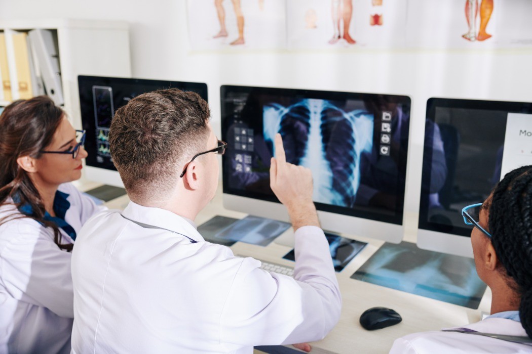 Três médicos de jaleco analisando radiografia de tórax em monitor de computador, com chapas de raio-X sobre a mesa, ilustrando conteúdo sobre nódulo pulmonar