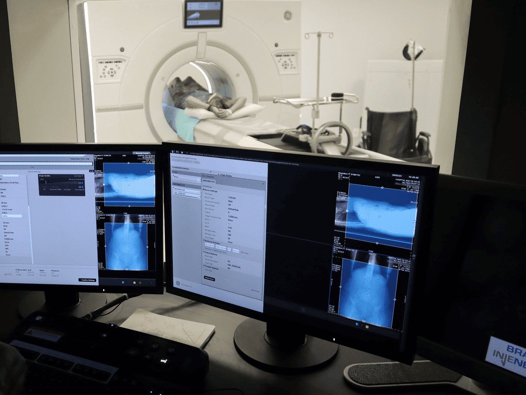Paciente deitado em aparelho de tomografia enquanto monitores exibem as imagens do exame, ilustrando a investigação de osteoporose sintomas e do risco de fraturas