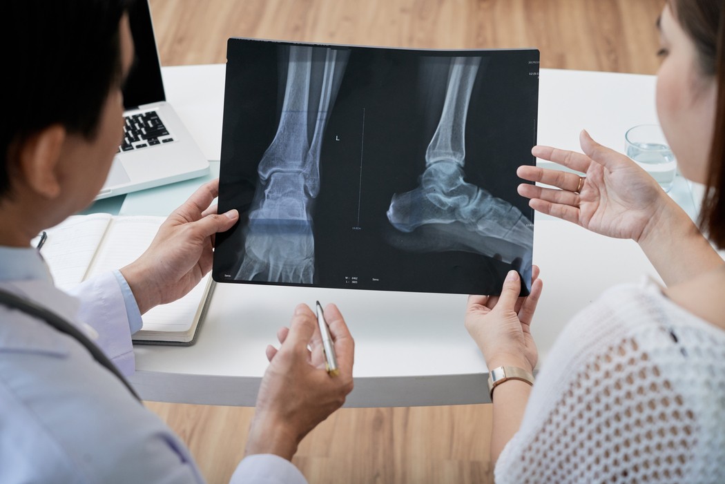 Médico e paciente analisando radiografia do tornozelo e do pé em consulta, ilustrando a avaliação de osteoporose sintomas e do risco de fraturas