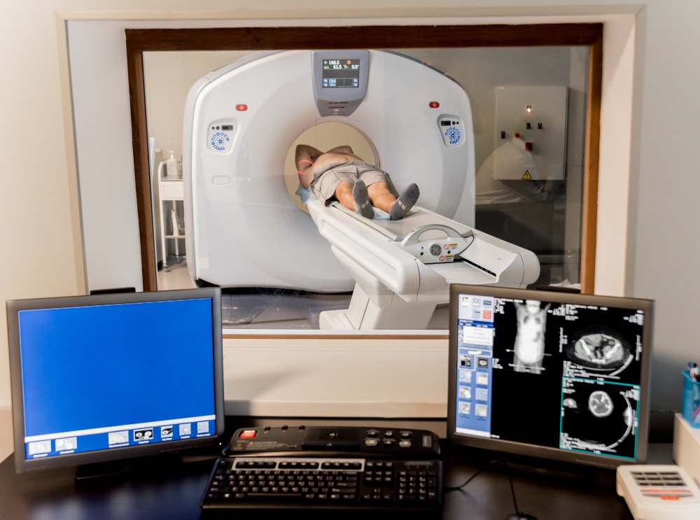Paciente deitado em equipamento de tomografia computadorizada, com monitores de controle e imagens médicas ao fundo, ilustrando artigo sobre quando procurar um oncologista
