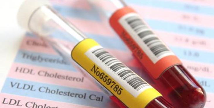 Entenda a importância dos cuidados e prevenção com o colesterol alto